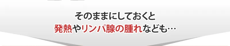 そのままにしておくと発熱やリンパ腺の腫れの原因にも…
